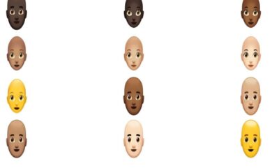 آیا دچار ریزش مو هستید؟ تشخیص ریزش مو با هوش مصنوعی MyHair AI