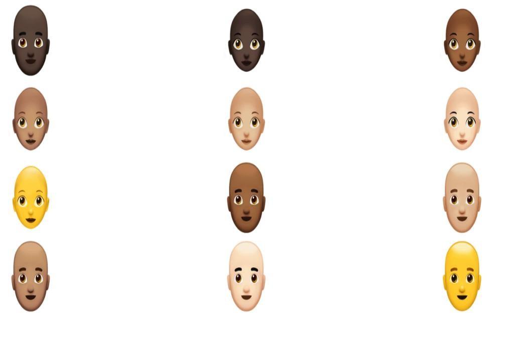 آیا دچار ریزش مو هستید؟ تشخیص ریزش مو با هوش مصنوعی MyHair AI